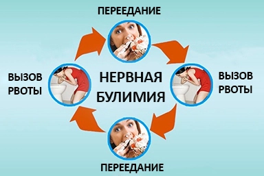 Лечение булимии в Анжеро-Судженске